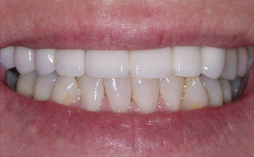 cosmetic dentistry gold coast