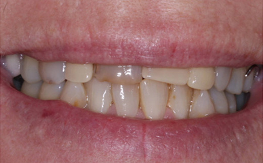 cosmetic dentistry gold coast