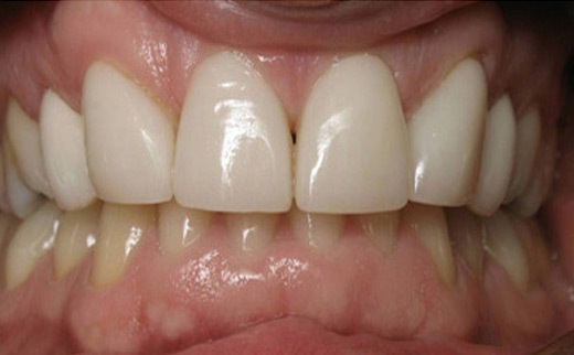 cosmetic dentistry gold coast