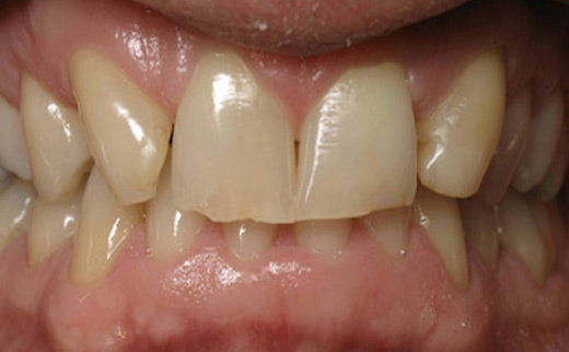 cosmetic dentistry gold coast